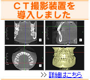 ＣＴ撮影装置を導入しました