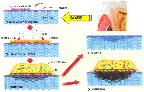 oCItBɂ钎̐藧