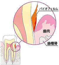 oCItB